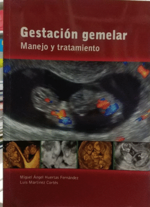 GESTACIÓN GEMELAR. MANEJO Y TRATAMIENTO