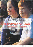 EL SINDROME DE DOWN